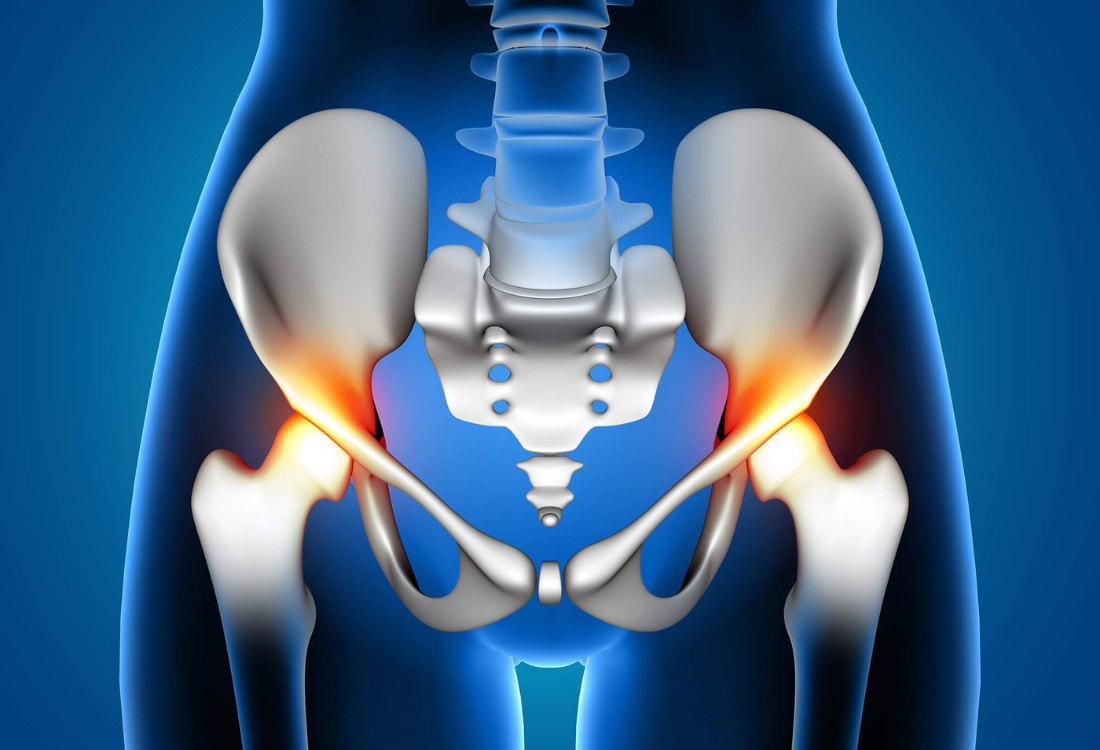 Conventional Joint replacement surgery in bhubaneswar .